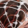 Quantitative Electroencephalography (QEEG)